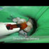 Accudose High Viscosity Tubes