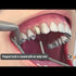 Dryz Blu Gingival Hemostatic Retraction Paste