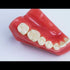 Predicta Bioactive Core Build-Up