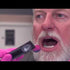 FluoroDose Varnish