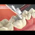 3M™ Sof-Lex™ Diamond Polishing System