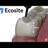 Ecosite Bulk Fill Composite