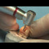Great White Ultra Series Burs